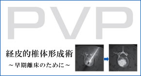 PVP経皮的椎体形成術